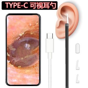 اینتراسکوپ گوش Type-C با دوربین HD برای پاکسازی گوش